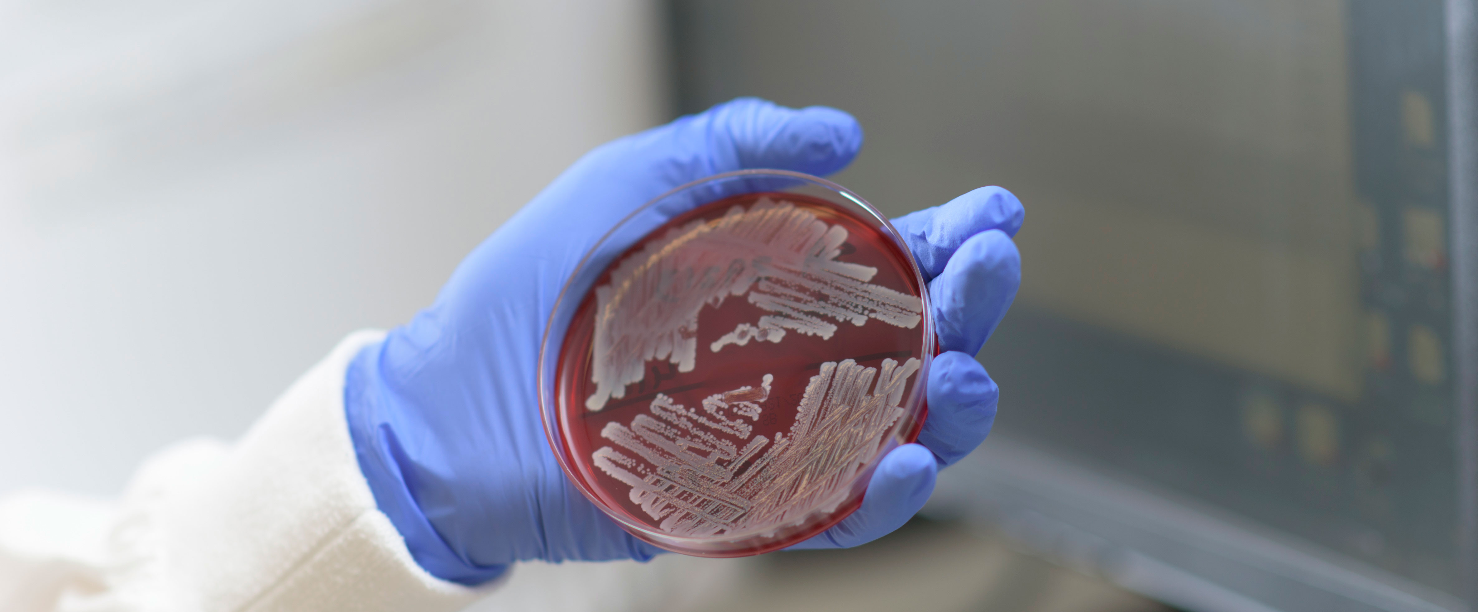 petri dish with bacteria